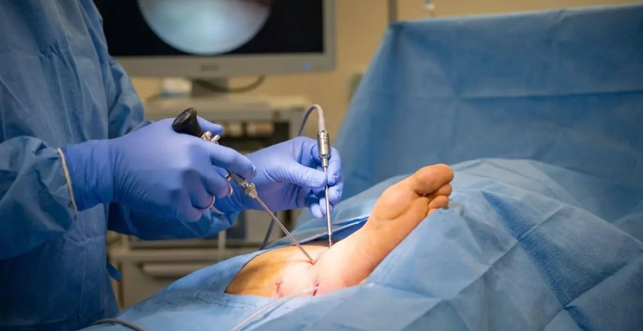 Chirurgien réalisant une intervention percutanée sur le pied d'un patient en salle d'opération